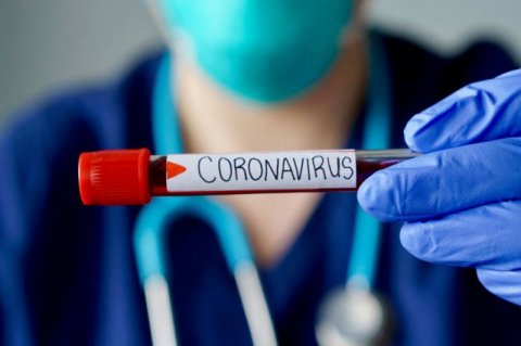 Azərbaycan koronavirusu müəyyənləşdirmək üçün test sistemi alır