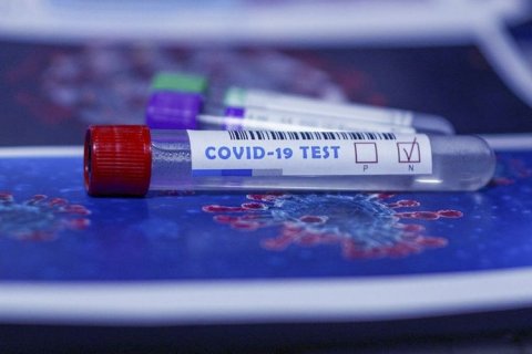 Gürcüstanda koronavirusa yoluxanların sayı 9 mini ötüb