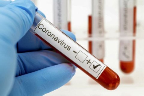 Koronavirus testlərinin sayı açıqlandı