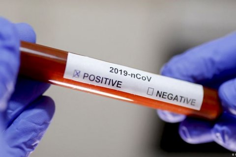 Rusiyada koronavirusa sutkalıq yoluxma və ölüm sayında rekord qeydə alınıb
