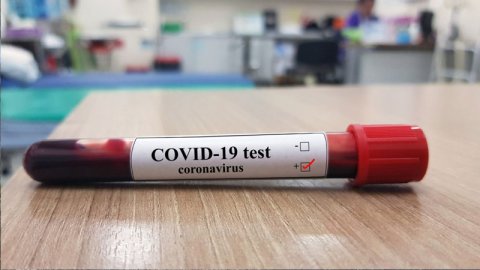 Azərbaycanda koronavirusa yoluxanların sayı artdı, 2 nəfər öldü