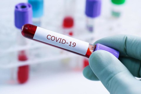 Gürcüstanda daha 290 nəfər koronavirusa yoluxub
