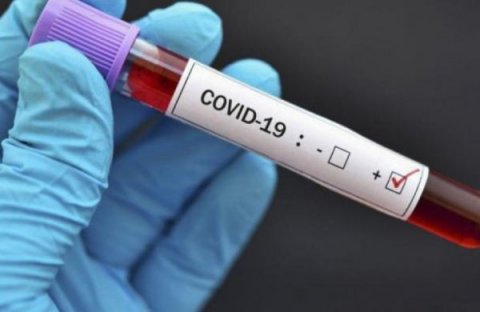 Cəmi 370 aktiv koronavirus xəstəsi qalıb