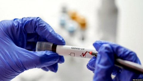 Azərbaycanda COVİD-19-a yoluxanlar var - RƏSMİ